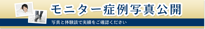 モニター症例写真公開