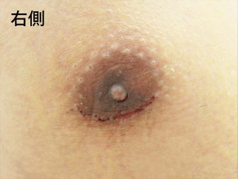 症例