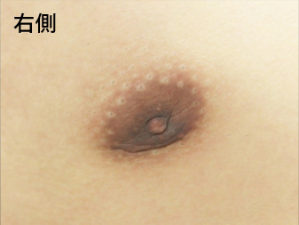 症例