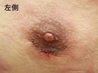 症例
