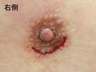 症例