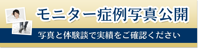 モニター症例写真公開
